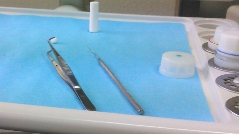 Tinnitus weg nach Zahnbehandlung
