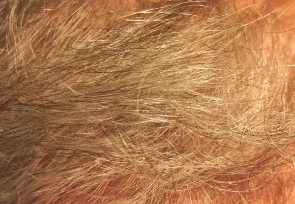 Was hilft gegen Haarausfall Hausmittel & Tipps Frag Mutti