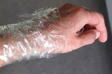 "Verband" aus Frischhaltefolie