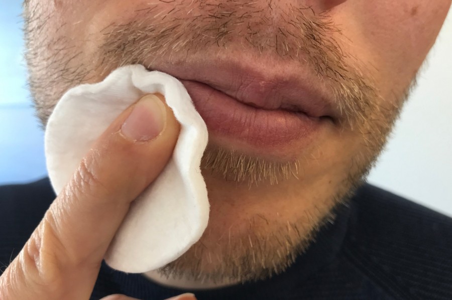 Im durchsichtiges mund bläschen Mundfäule: Symptome