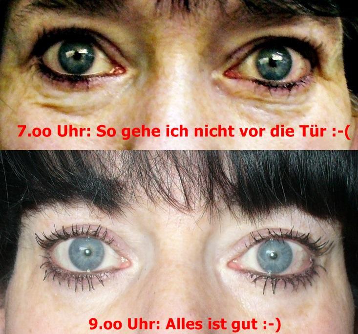 Koffein Augen Roll On Gegen Tranensacke Augenringe Schwellungen