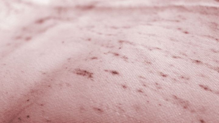 Ein besch&auml;digter Stoff zeigt Flecken. Essig wird verwendet, um Stockflecken zu entfernen und den Stoff zu reinigen.