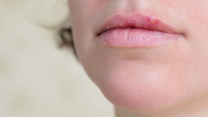 Eine Nahaufnahme von Lippen, die sanft aufeinanderliegen, umgeben von einer neutrale Wand, deutet auf Herpestherapie mit Honig hin.
