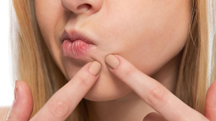 Eine Person mit langen Haaren dr&uuml;ckt mit den Fingern gegen einen Pickel auf ihrer Wange, um unreine Haut zu behandeln.