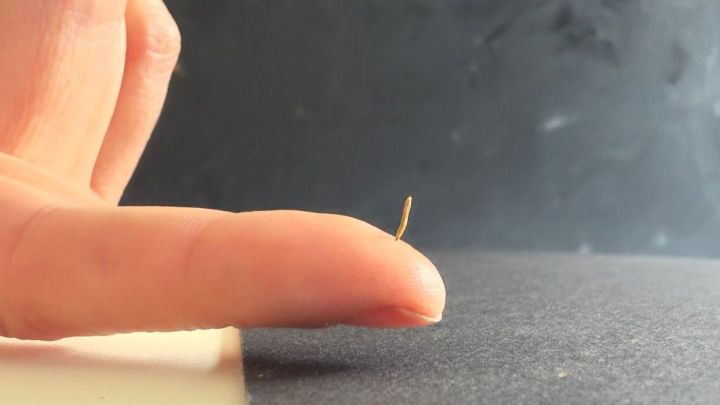 Hast du einen Splitter im Finger? Der Artikel erkl&auml;rt, wie du ihn einfach entfernen kannst. Das Bild zeigt einen eingedrungenen Holzsplitter, der mit den richtigen Tipps schmerzfrei beseitigt werden kann.