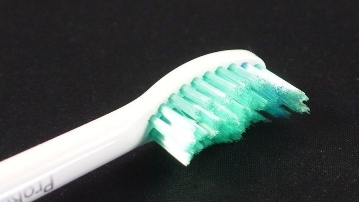 Eine Zahnb&uuml;rste mit gr&uuml;nen Borsten liegt auf einem schwarzen Hintergrund und scheint bereit zum Putzen der Z&auml;hne.