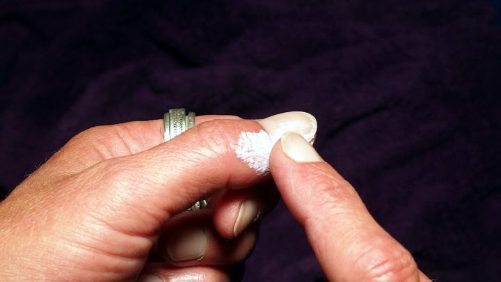 Eine Hand h&auml;lt eine kleine Menge Penaten Creme, w&auml;hrend sie sich auf einen verletzten Finger auftr&auml;gt.