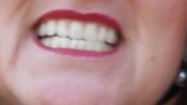 Eine Person mit rotem Lippenstift l&auml;chelt breit und zeigt ihre Z&auml;hne, was auf Zahntechnik und dentale Behandlung hinweist.