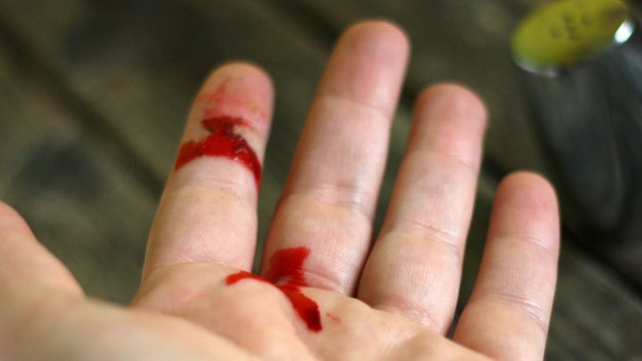 Eine Hand mit leichter Blutung zeigt Schnittwunden, w&auml;hrend im Hintergrund ein Pfefferstreuer steht.