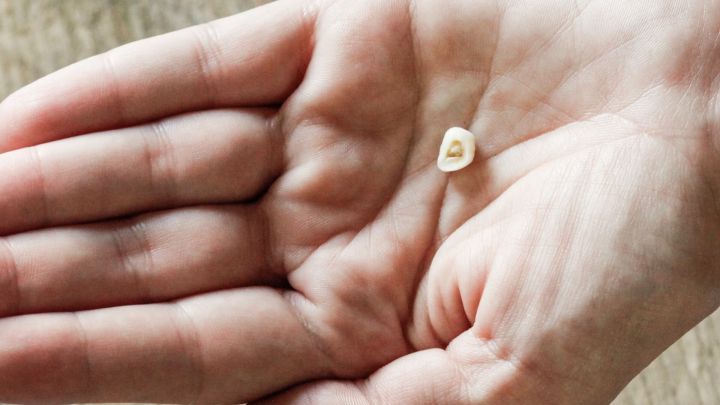 Ein Zahn liegt in einer Hand und zeigt deutlich den Verlust, als Symbol f&uuml;r einen Zahn, der ausgeschlagen wurde.