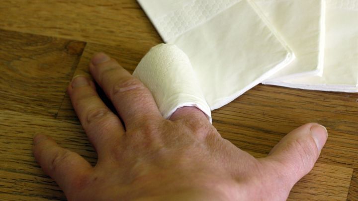 Ein Verband ist um einen verletzten Finger gewickelt, w&auml;hrend daneben weitere K&auml;ltet&uuml;cher auf einem Holztisch liegen.