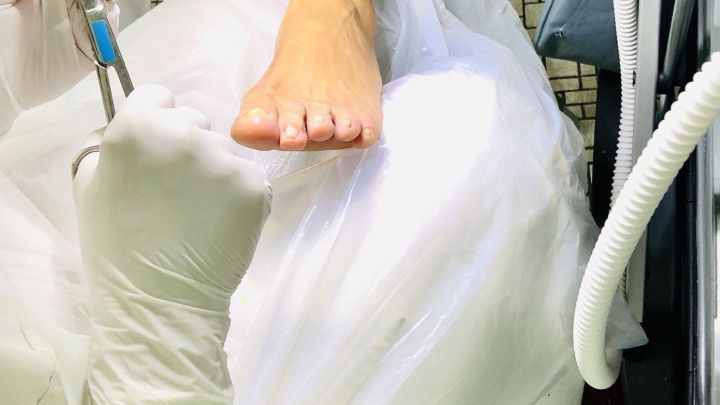 Eine Fu&szlig;pflege wird durchgef&uuml;hrt, w&auml;hrend die Warze behandelt wird; der Raum ist gut beleuchtet und hygienisch.