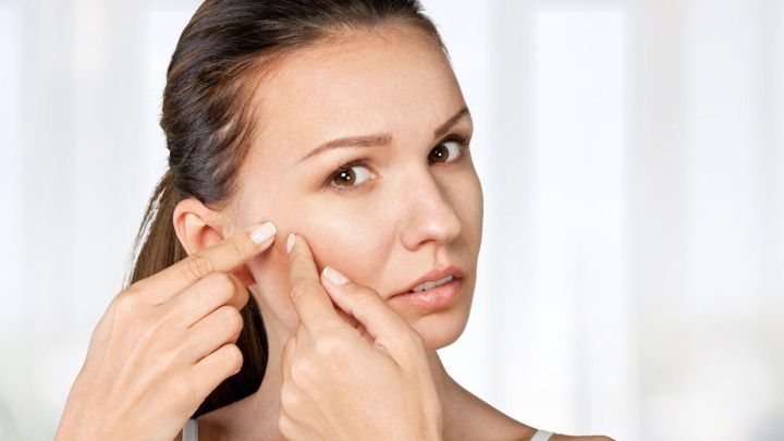 Eine Frau dr&uuml;ckt auf einen Pickel im Gesicht, um ihn zu entfernen, w&auml;hrend sie in einem hellen Raum steht.