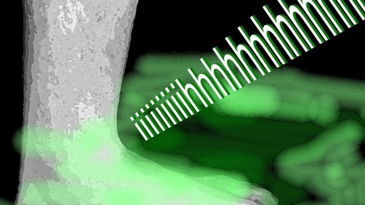 Schwei&szlig;f&uuml;&szlig;e m&uuml;ssen nicht sein: Mit diesen 7 Tipps aus dem Artikel bleibst Du frisch und sagst unangenehmem Geruch den Kampf an.