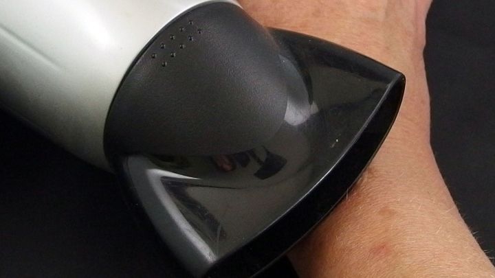 Ein F&ouml;hn wird verwendet, um den Juckreiz am Arm zu lindern, der durch einen Insektenstich verursacht wird.