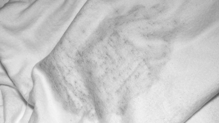 Ein wei&szlig;es Textil zeigt schimmelige Stockflecken, die auf die Notwendigkeit zur Reinigung hinweisen.