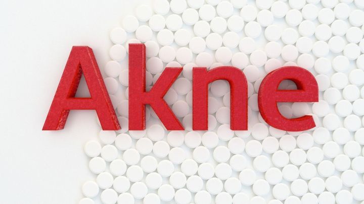 Roten Buchstaben aus "Akne" stehen auf einer wei&szlig;en Hintergrundleiste mit kleinen wei&szlig;en Tabletten, die den Fokus auf Hautprobleme lenken.