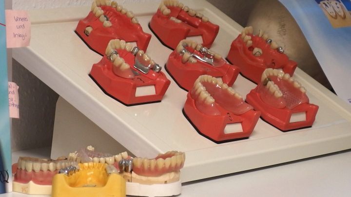 Zahnarztmodelle stehen auf einem Tisch, die Zahnprothesen zeigen verschiedene Formen und Einstellungen f&uuml;r den Zahnersatz.