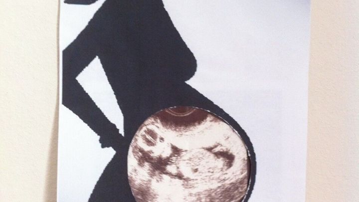 Eine schwangere Frau betrachtet ihren Bauch, in dem ein Ultraschallbild ihres Babys sichtbar ist, vor einem neutralen Hintergrund.