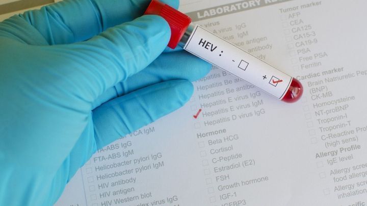 Ein Testglas mit Blut wird von einer Hand mit einem blauen Handschuh gehalten, w&auml;hrend ein Laborbericht im Hintergrund zu sehen ist.