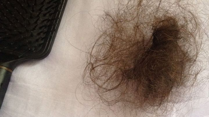 Ein Kamm liegt neben einem Verlust von Haaren auf einem wei&szlig;en Untergrund, was auf Haarausfall durch Stillen hinweist.