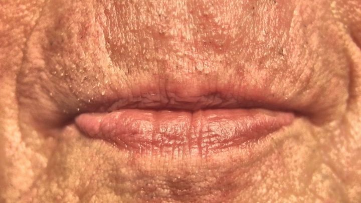 Rauhe Lippen mit trockener, faltiger Haut zeigen Anzeichen von Alterung und m&ouml;glicherweise unzureichender Pflege.