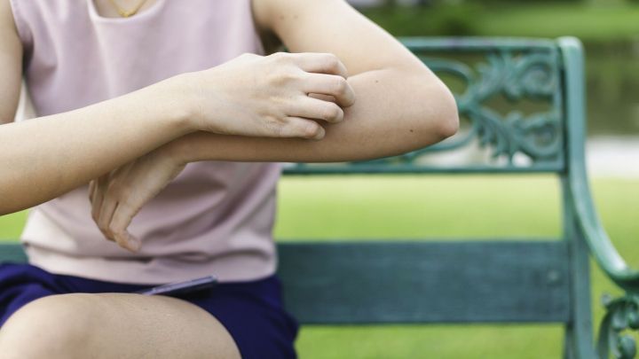 Eine Person kratzt an einem M&uuml;ckenstich am Arm, w&auml;hrend sie auf einer Bank im Freien sitzt, umgeben von Gr&uuml;n.