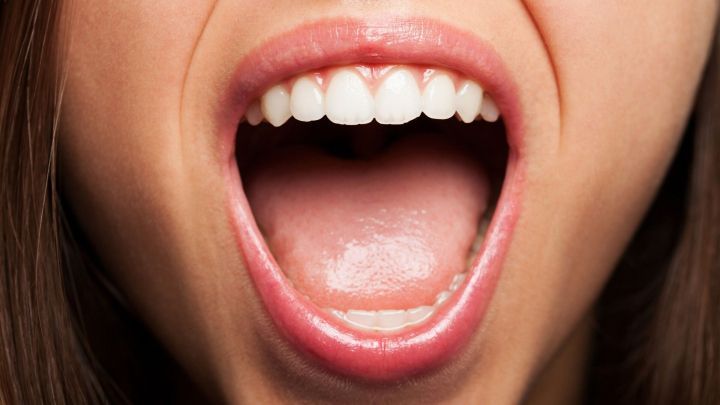 Ein offener Mund mit sichtbaren wei&szlig;en Z&auml;hnen und einer Zunge, die auf Mundschleimhautentz&uuml;ndung hinweist.