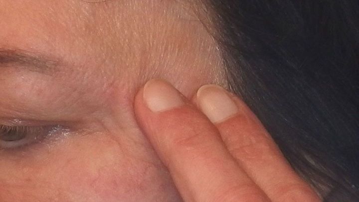 Eine Person h&auml;lt sanft ihren Finger gegen die Schl&auml;fe, um Kopfschmerzen zu lindern, w&auml;hrend Teebaum&ouml;l im Hintergrund steht.