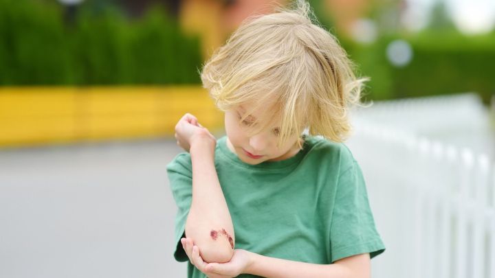 Ein Junge mit unordentlichem, blondem Haar betrachtet eine blutende Wunde an seinem Ellbogen in einer gr&uuml;nen Umgebung.