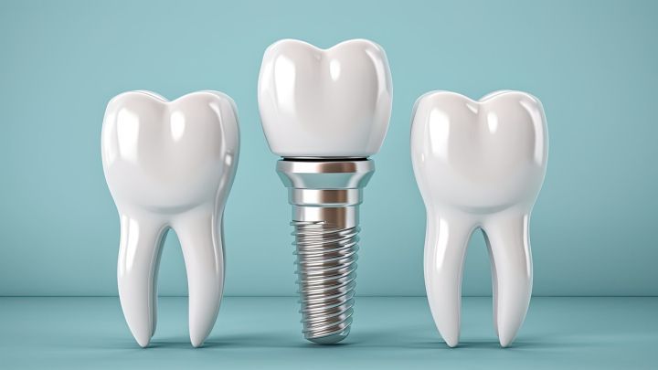 Zahnersatz aus dem Ausland kann eine kosteng&uuml;nstige Option sein. &Uuml;berlege, ob du eine solche Behandlung in Erw&auml;gung ziehst, um Geld zu sparen. Der Artikel gibt wertvolle Tipps und zeigt, worauf du achten solltest.
