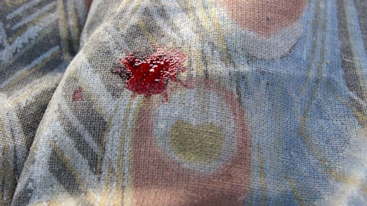 Ein roter Blutfleck auf einem hellen, gemusterten Stoff zeigt die Herausforderung von Fleckenentfernung im Alltag.