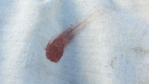Ein blauer Stoff zeigt einen alten, hartnäckigen Blutfleck, der die Notwendigkeit zur Entfernung mit Backhefe verdeutlicht.