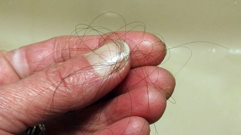 Eine Hand hält verfilzte Haare, die aus einem Abfluss gezogen wurden, um eine Verstopfung zu lösen.