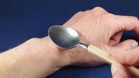 Eine Hand benutzt einen Löffel, um über einen Mückenstich auf dem Handgelenk zu fahren, um Schmerzen zu lindern.