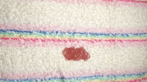 Blutfleck entfernen: Ich feuchte den Fleck mit kaltem oder lauwarmem Wasser an und verreibe eine gute Portion flüssige Handseife auf dem Fleck. Dann ab damit in die Waschmaschine. Auf einem hellen Handtuch mit bunten Streifen liegt ein roter Blutfleck, der eine sorgfältige Entfernung erfordert.