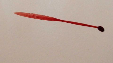 Eingetrocknetes Blut lässt sich mit nichts schneller von glatten Oberflächen entfernen, als mit Fensterreiniger. Einfach den Reiniger aufsprühen, kurz einwirken lassen und weg ist der Fleck. Ein blutiger Fleck liegt auf einer hellen Oberfläche und zeigt, dass Fensterreiniger zum Entfernen verwendet werden könnte.