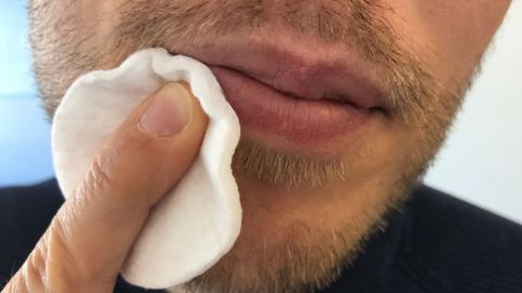 Ein Mann behandelt seine Lippen mit einem Wattepad, um Herpes zu bekämpfen, in einem neutralen Raum.