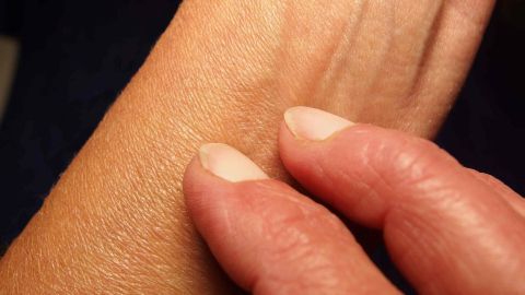 Ein Tropfen Wachs von einer brennenden Kerze nach einem Mückenstich und das Jucken ist vorbei. Eine Hand berührt sanft eine Hautstelle, um Jucken bei Mückenstichen zu lindern.