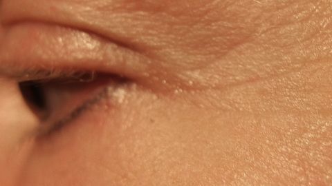Krähenfüße sind deutlich um das Auge sichtbar, während die Haut darunter weich und leicht gefaltet ist.