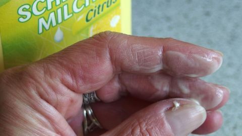 Nikotinablagerungen an Fingern mit Scheuermilch entfernen. Eine Hand hält Scheuermilch, während sie zur Säuberung von Nikotinfinger verwendet wird, auf einer küchenähnlichen Oberfläche.