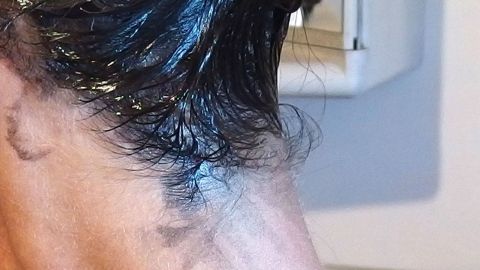 Ein Nacken mit dunklen Haaren, wo sich eine Hautverfärbung zeigt, die möglicherweise von Haarfarbe stammt.
