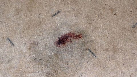 Ein blutiger Fleck liegt auf einem hellen Teppich, umgeben von feinen Fasern, die die Oberfläche leicht strukturieren.