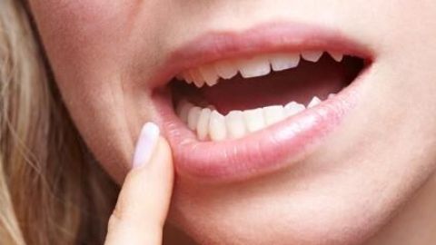 Eine Person zeigt mit dem Finger auf ihre Zähne, während der Mund leicht geöffnet ist, in einem hellen Umfeld.