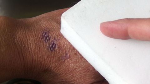 Beim Feiern bleibt am nächsten Tag oftmals nicht nur der Kater, sondern auch die Stempelfarbe zurück. Diese kann mit einem Schmutzradierer von der Haut entfernt werden. Eine Hand hält einen Schmutzradierer, der über Stempelfarbe auf der Haut gleitet, um sie zu entfernen.