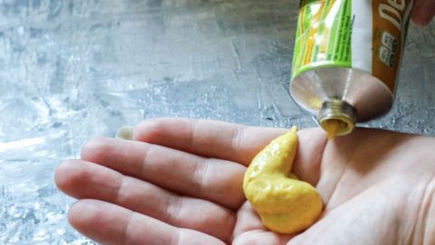 Eine Hand drückt Senf aus einer Tube in die geöffnete Handfläche, um ihn gegen Schuppenflechte zu verwenden.