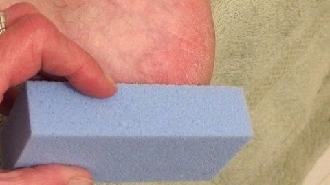 Ein blauer Bimsstein wird von einer Hand gehalten, während er zur Entfernung von Hornhaut an einem Fuß verwendet wird.