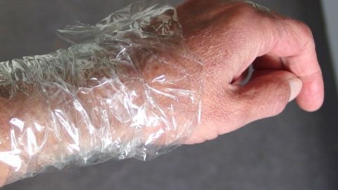 Mit einem "Verband" aus Frischhaltefolie bleibt die Salbe an Ort und Stelle. Ein mit Frischhaltefolie umwickelter Arm liegt auf einer grauen Oberfläche, was eine unscharfe, alltägliche Umgebung zeigt.