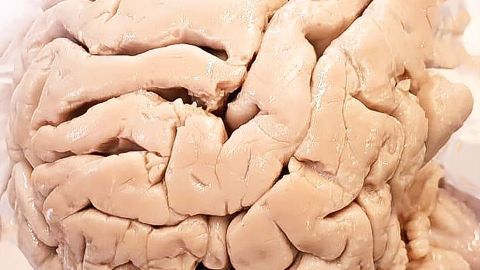 Ein menschliches Gehirn liegt auf einem weißen Untergrund und zeigt die gewundene Oberfläche, die für das Gedächtnistraining wichtig ist.