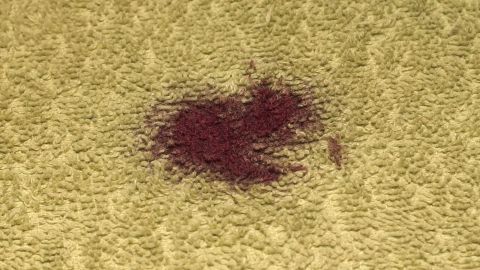 Mit Glasreinigerspray kann Rotwein aus fast aus allen Materialien (auch Teppich) entfernt werden. Einfach einsprühen - einwirken lassen - mit Küchentuch abtupfen - der Fleck ist weg!
